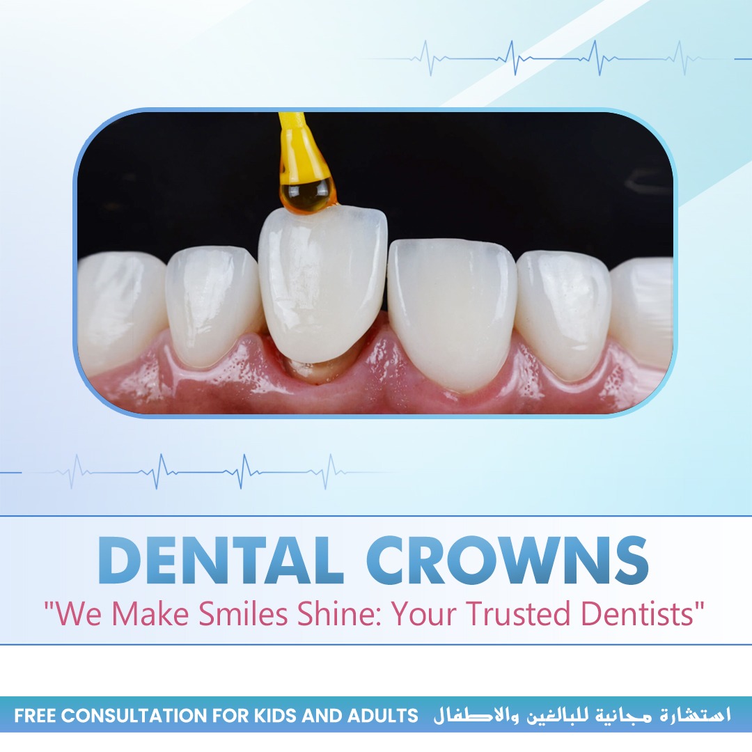 Dental Crowns