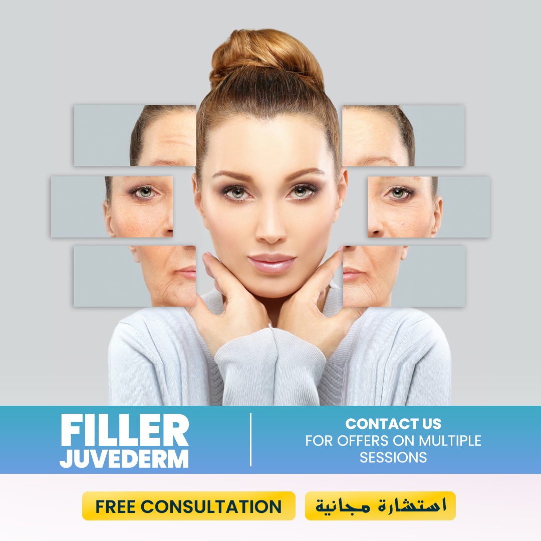 Filler Juvederm