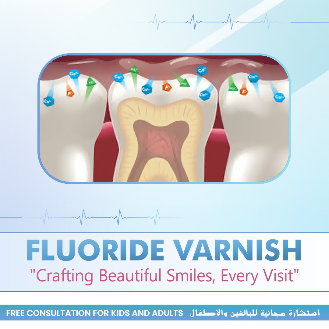 Fluoride Varnish